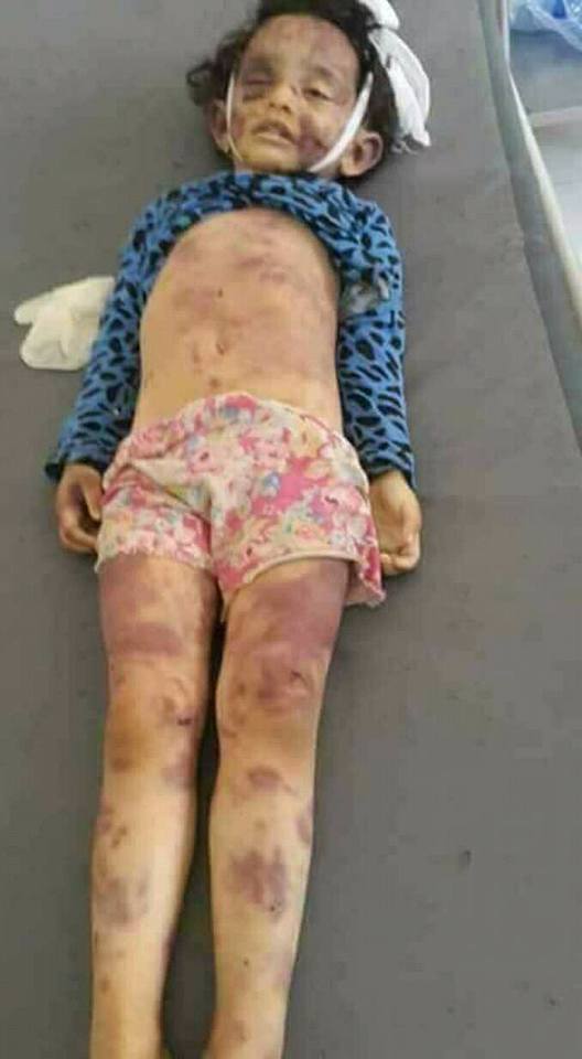 شاب يغتصب بنت اخته ويقتلها بمرسى مطروح