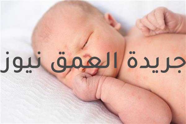 «بعد انتشاره بين الأطفال».. أعراض فيروس «الحمى الوردية»